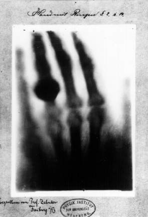 First_medical_X-ray_by_Wilhelm_Röntgen_of_his_wife_Anna_Bertha_Ludwig's_hand_-_18951222.gif